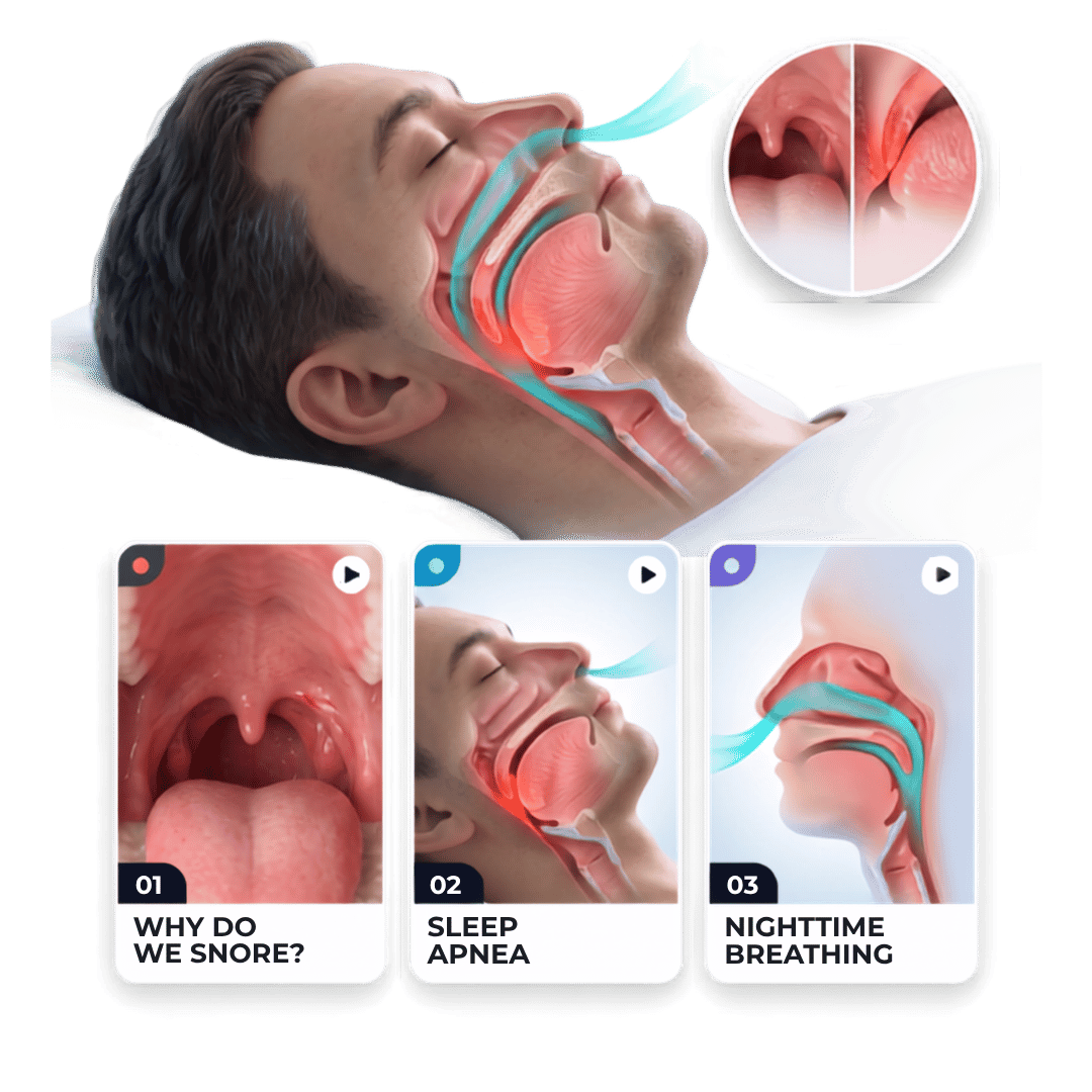 Mockup Snoring and Apnea 3D